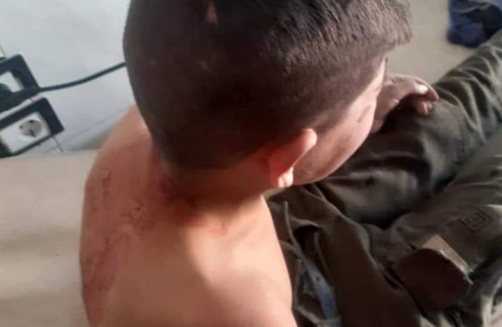 Photo of إصابة أربعة أطفال جراء قصف الاحتلال التركي على تل رفعت