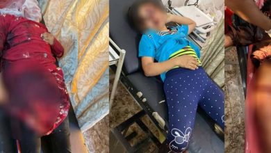 Photo of شهداء وجرحى بينهم أطفال خلال قصف للاحتلال التركي على ناحية زركان